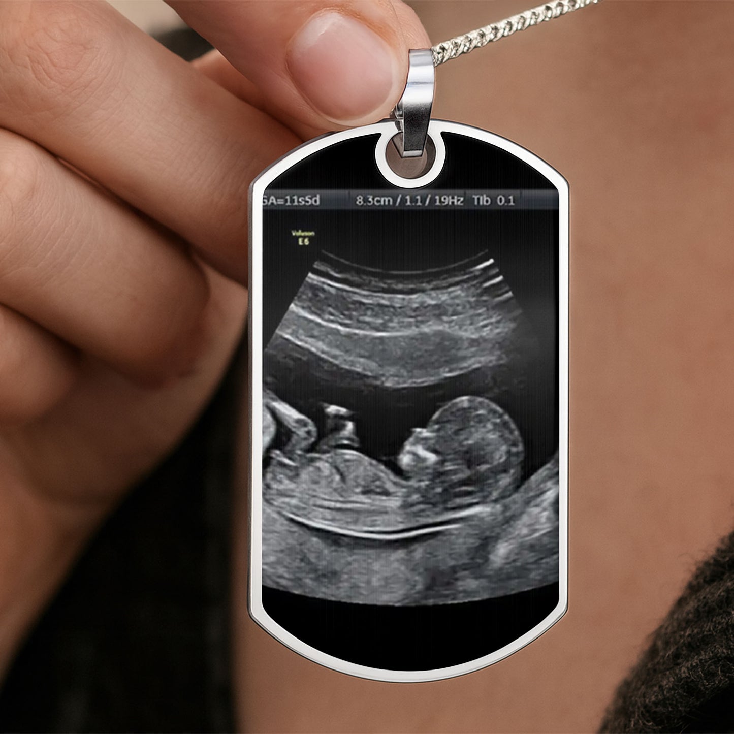 Stay Safe Daddy, I'll Be In Your Arms Soon, Ultrasound Image