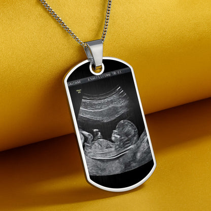 Stay Safe Daddy, I'll Be In Your Arms Soon, Ultrasound Image