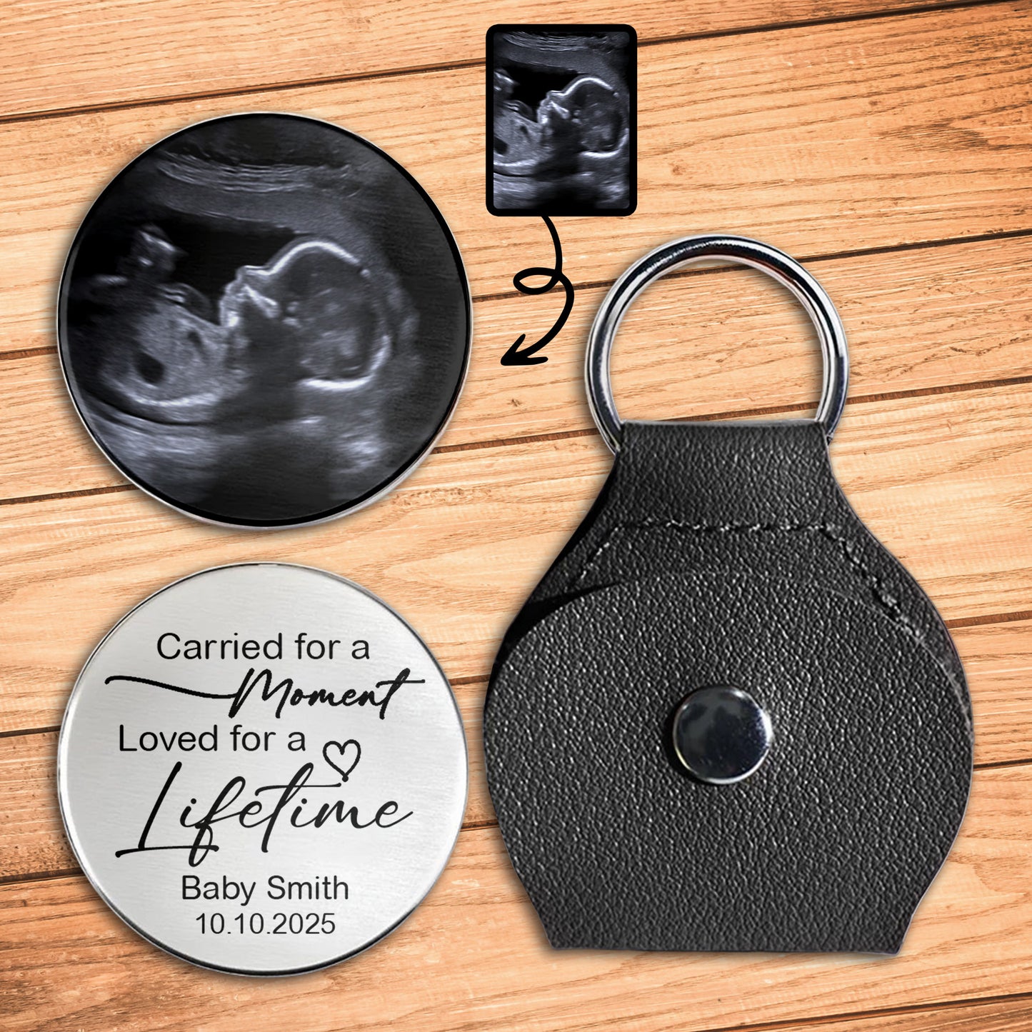 Carried For A Moment, Loved For A Lifetime, Ultrasound Image