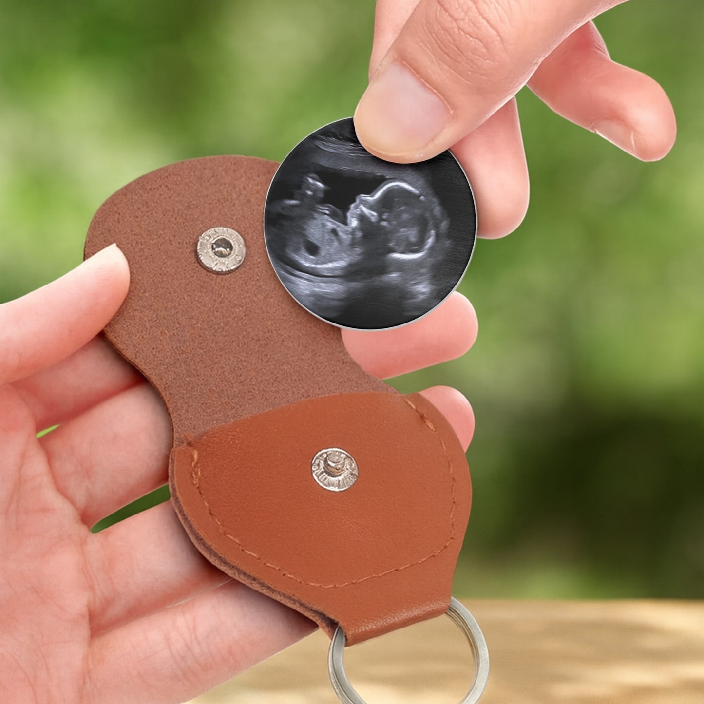 Carried For A Moment, Loved For A Lifetime, Ultrasound Image