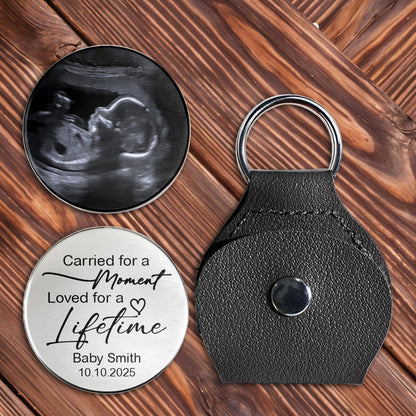 Carried For A Moment, Loved For A Lifetime, Ultrasound Image