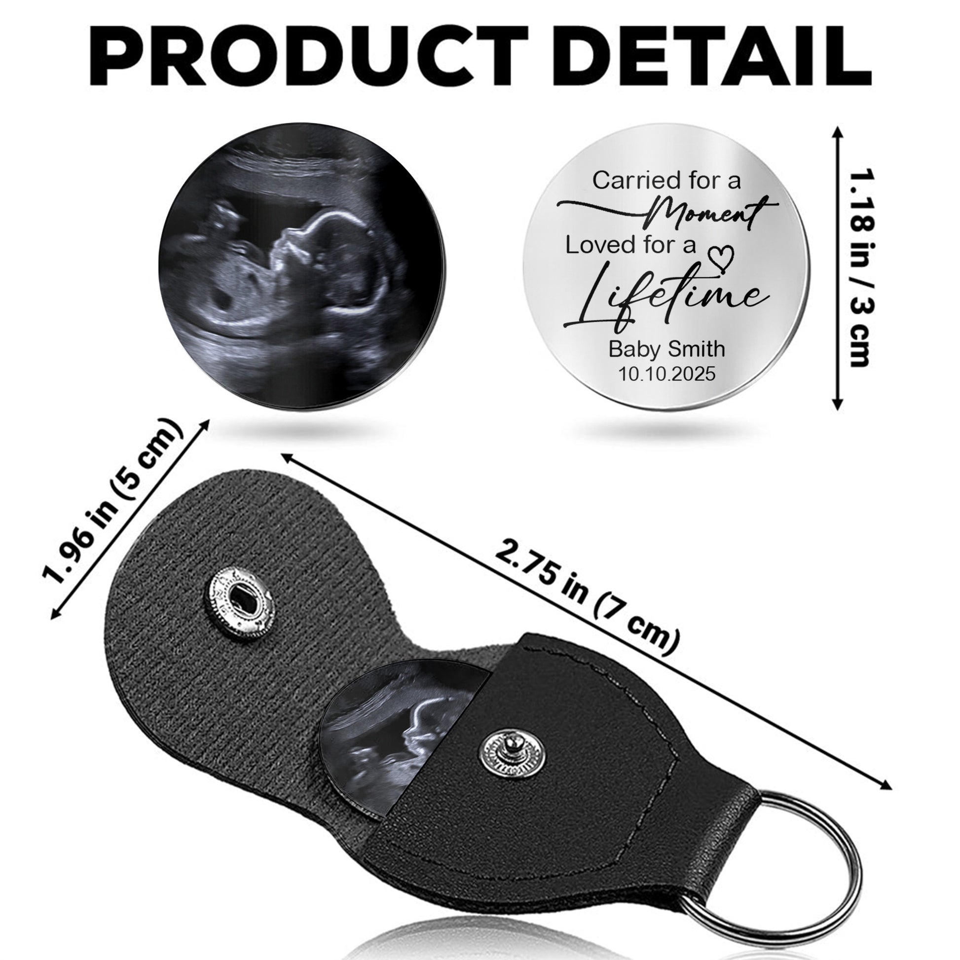 Carried For A Moment, Loved For A Lifetime, Ultrasound Image