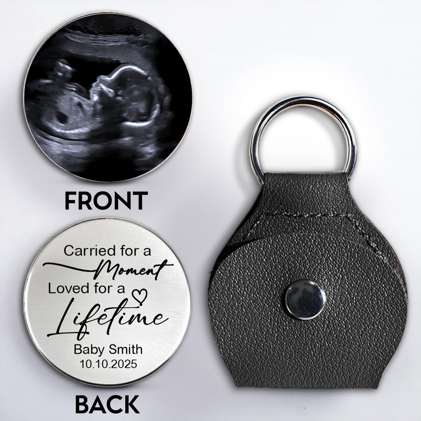 Carried For A Moment, Loved For A Lifetime, Ultrasound Image