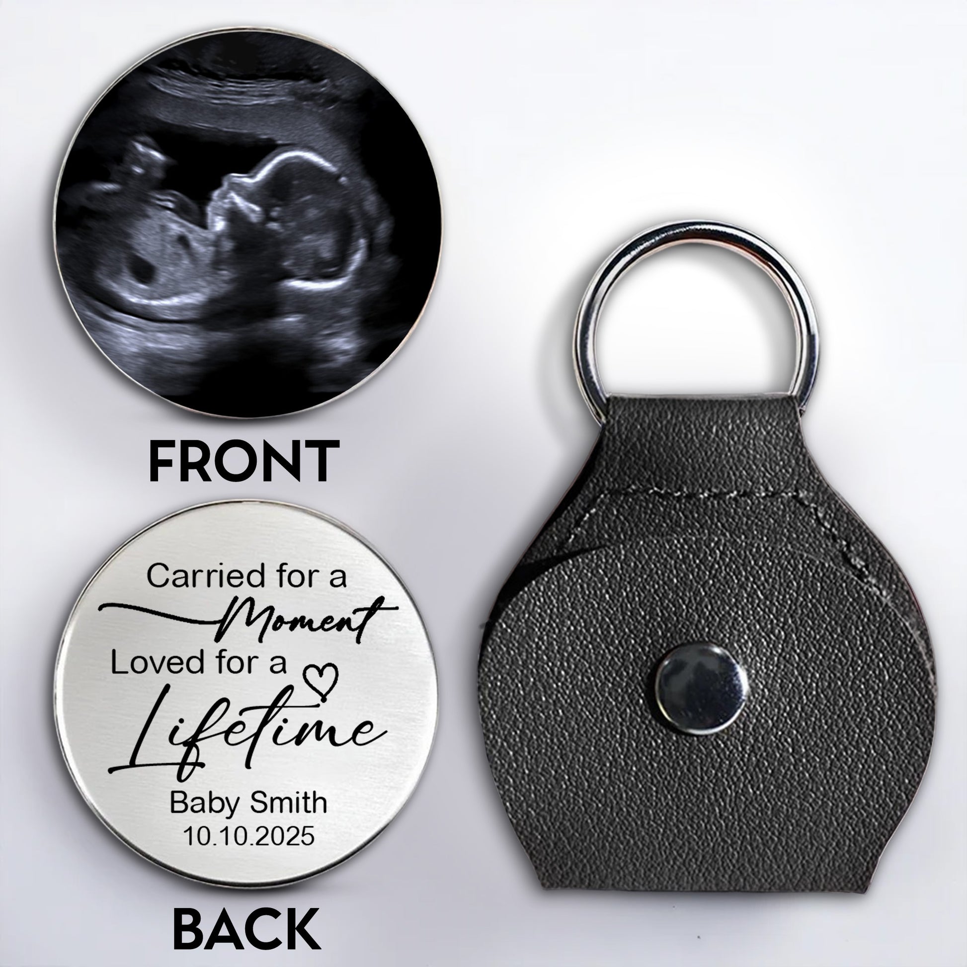 Carried For A Moment, Loved For A Lifetime, Ultrasound Image