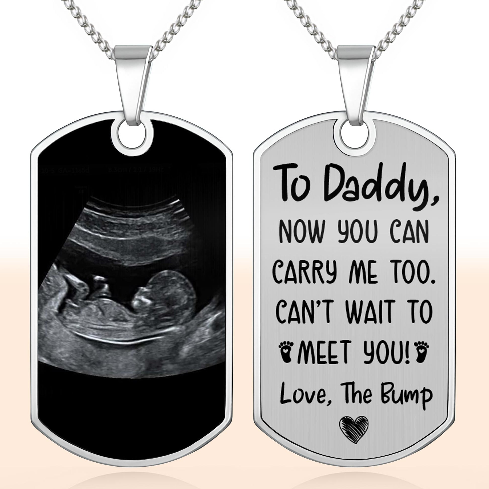 To Daddy Now You Can Carry Me Too, Ultrasound And Heart