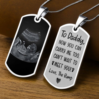 To Daddy Now You Can Carry Me Too, Ultrasound And Heart