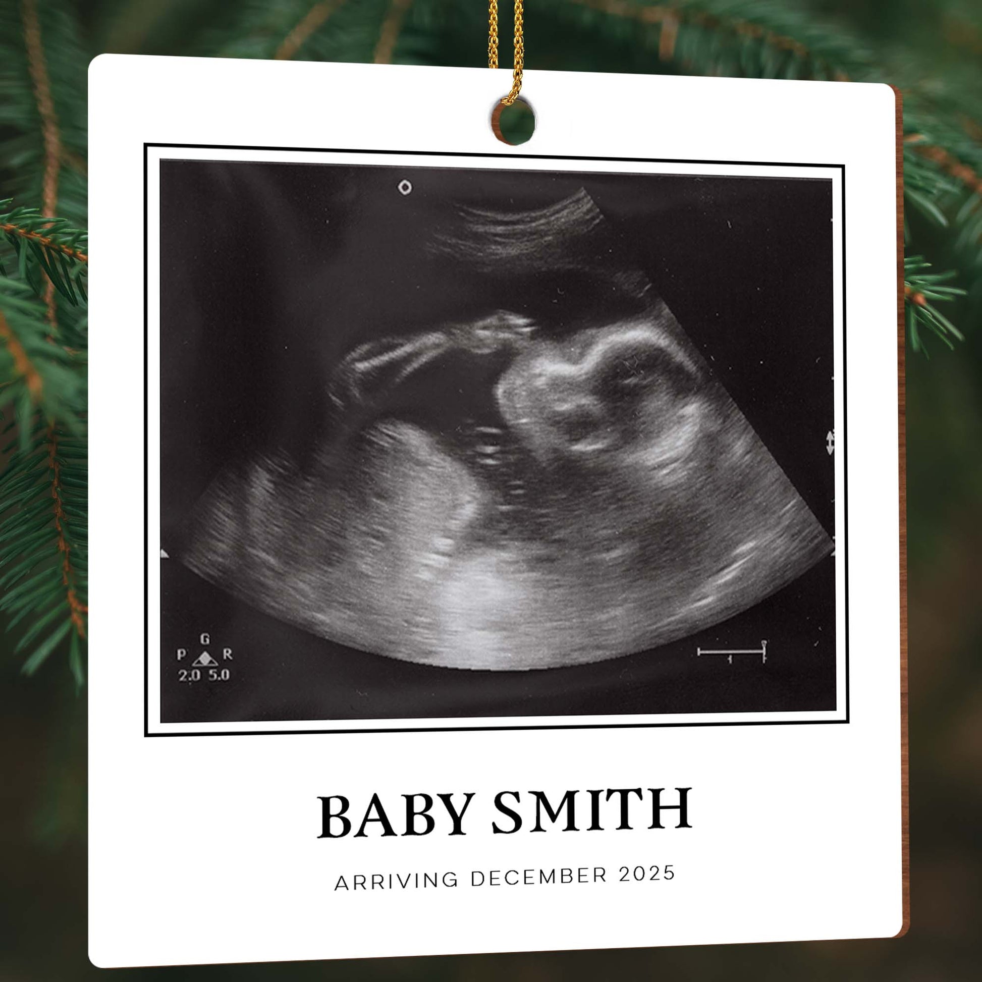 Celebrating A New Arrival, Custom Ultrasound Keepsake