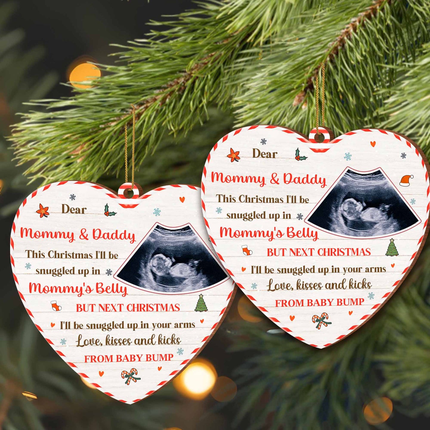 Snuggled Up in Mommy's Belly This Christmas, Ultrasound Image