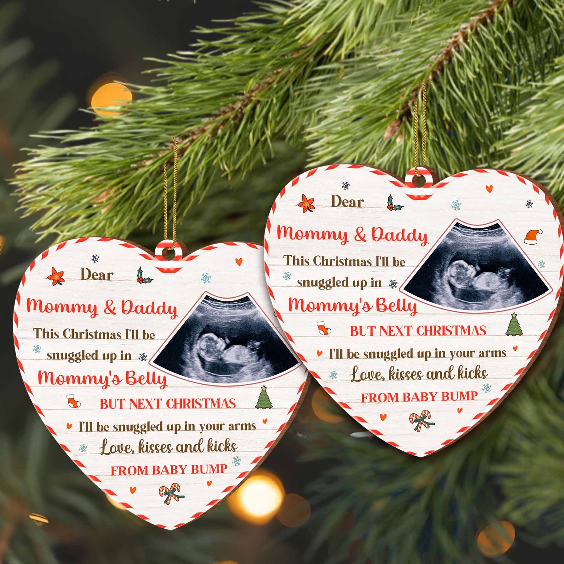 Snuggled Up in Mommy's Belly This Christmas, Ultrasound Image